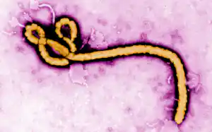 エボラウイルスの電子顕微鏡画像=米国疾病対策センター(CDC)・AP エボラウイルスの電子顕微鏡画像=米国疾病対策センター(CDC)・AP