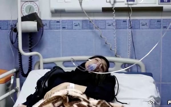 毒ガスで攻撃され病院に運ばれたイランの女性（２日の映像から、撮影場所は不明）＝ロイター