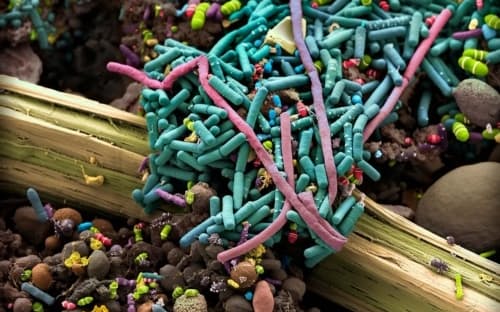 人間の腸内細菌は、食物の消化や栄養素の吸収を助けるなど、健康にとって欠かせない役割を果たしている。写真は、人間の排泄物にさまざまな細菌が含まれていることがわかる走査型電子顕微鏡（SEM）画像（手動で着色）。（PHOTOGRAPH BY MARTIN OEGGERLI, MICRONAUT. KINDLY SUPPORTED BY UNIVERSITY HOSPITAL BASEL AND SCHOOL OF LIFE SCIENCES, FHNW）
