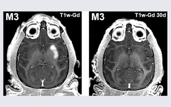 サルのMRI画像。血液脳関門が開いた直後（左）は脳の一部に造影剤が届いて白く見えている。30日後（右）には血液脳関門が既に閉じている（京都大学提供）