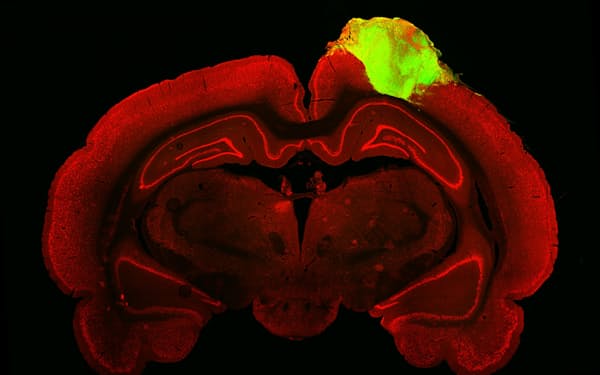 ラットの脳に移植された人の脳オルガノイド（右上の緑に光る部分）＝ペンシルベニア大学提供