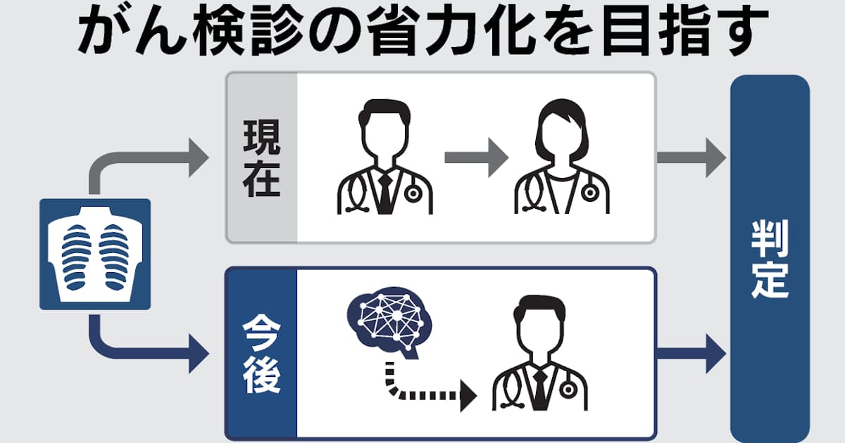 がん検診、医師2人→1人で可能に 異常検出でAI活用も検討 - 日本経済新聞