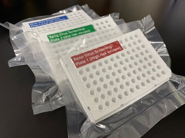 国立国際医療研究センター、1型糖尿病にブタの細胞移植 - 日本経済新聞