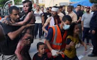 イスラエルの爆撃で負傷し、病院に運ばれるパレスチナ自治区ガザの子どもたち（10月31日）＝ＡＰ