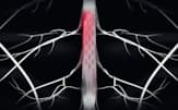 パーキンソン病患者の背骨の中に電極を埋め込み、歩行を補助するように脊髄を電気刺激する（イメージ）=EPFL提供