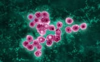 彩色した水痘・帯状疱疹ウイルスの透過型電子顕微鏡画像。（MICROGRAPH BY JAMES CAVALLINI, SCIENCE PHOTO LIBRARY）