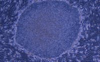線維芽細胞から樹立したヒトiPS細胞のコロニー（集合体）＝山中伸弥・京都大学教授提供