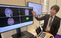 将来の脳画像を予測する生成AIを開発した（16日、東京都千代田区）