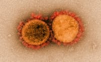 新型コロナの原因ウイルスSARS-CoV-2＝米国立アレルギー感染症研究所・ロイター