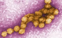 ウエストナイルウイルスの電子顕微鏡写真＝米疾病対策センター（CDC）提供