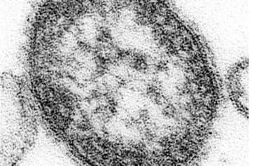 はしかのウイルスの電子顕微鏡写真=米疾病対策センター提供・共同