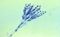 アオカビの一種の顕微鏡写真＝米疾病対策センター（CDC）提供