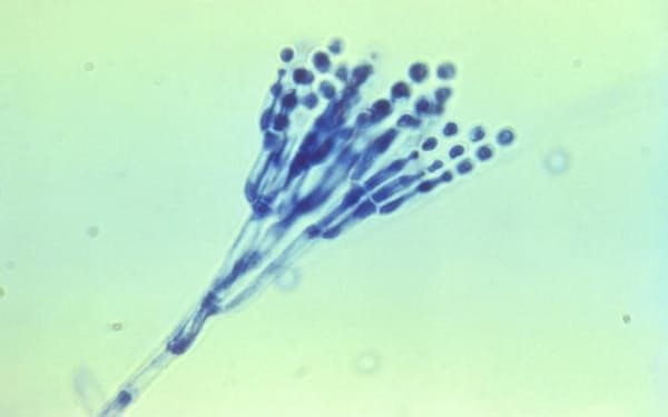 アオカビの一種の顕微鏡写真=米疾病対策センター（CDC）提供