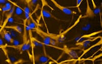ヒトのiPS細胞から脳のグリア細胞の一種「アストロサイト」を効率良く作る技術を開発した＝理化学研究所提供