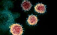 新型コロナウイルスの電子顕微鏡写真＝米国立アレルギー感染症研究所提供