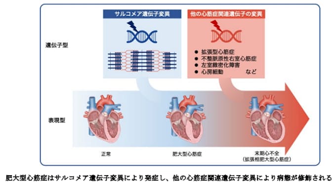 肥大型心筋症の重症化に関わる遺伝的リスク因子を同定~多様性に富む病態形成の機序解明に網羅的遺伝子解析が有用~ 肥大型心筋症の重症化に関わる遺伝的リスク因子を同定~多様性に富む病態形成の機序解明に網羅的遺伝子解析が有用~