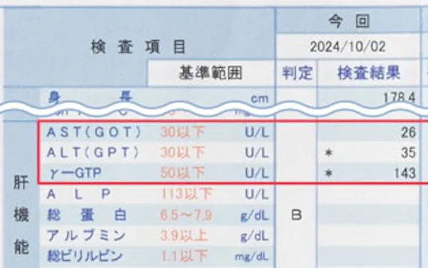 「該当すれば9割脂肪肝」の検査項目
