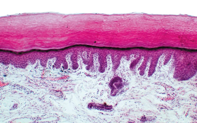 指の皮膚から採った上皮細胞(Yaroslav Stepaniuk/Alamy Stock Photo) 指の皮膚から採った上皮細胞(Yaroslav Stepaniuk/Alamy Stock Photo)