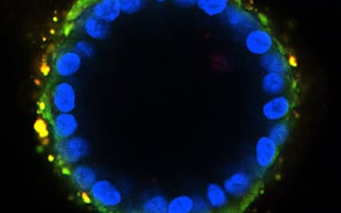 作製したオルガノイド=東京科学大提供