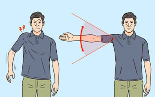 放置厳禁な肩の痛み、見分け方は?