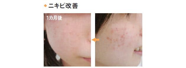 肌がしっとり もちもちになる 砂糖で洗顔 Nikkei Style 肌がしっとり もちもちになる 砂糖で洗顔 Nikkei Style