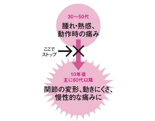 手の痛みに厳禁の つまみ動作 道具使って負担減 Nikkei Style 手の痛みに厳禁の つまみ動作 道具使って負担減 Nikkei Style