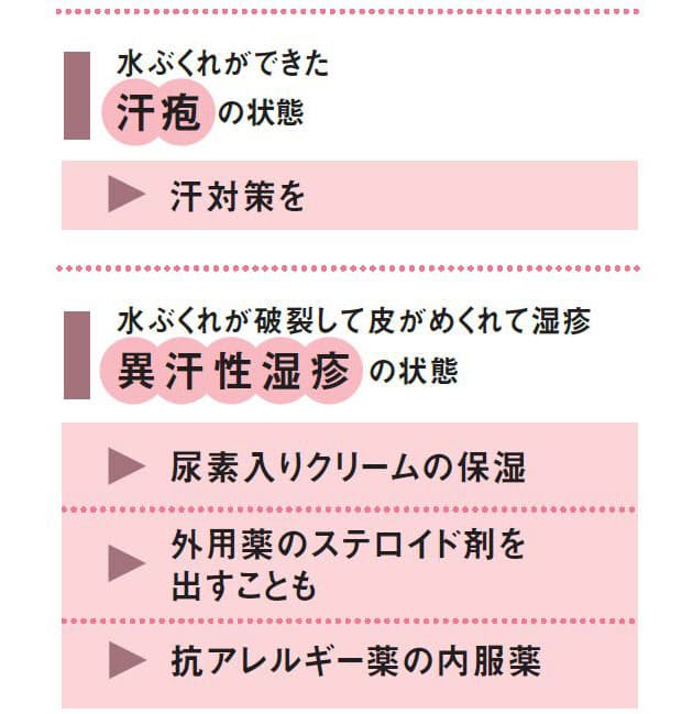 汗疱が悪化したら皮膚科へ ステロイド塗り保湿 Nikkei Style 汗疱が悪化したら皮膚科へ ステロイド塗り保湿 Nikkei Style