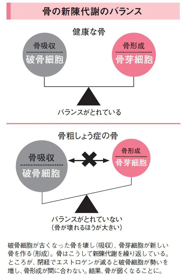 骨が弱いと老け顔に 40代の1割が 骨貯金不足 Nikkei Style