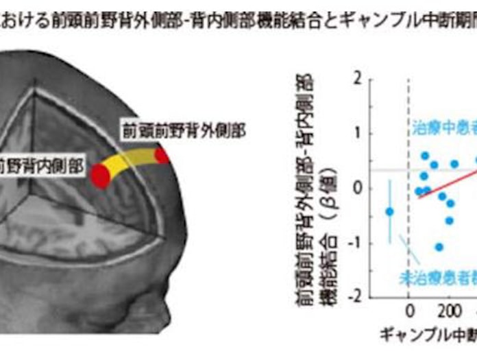 京大 ギャンブル依存症の神経メカニズム を解明 日本経済新聞