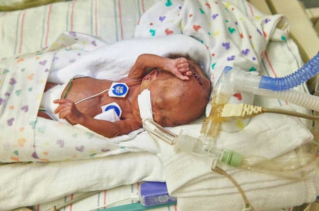 人工子宮でヒツジの赤ちゃんが発育 ヒトへの応用は Nikkei Style 人工子宮でヒツジの赤ちゃんが発育 ヒトへの応用は Nikkei Style