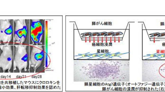 九大 オートファジーが膵癌を支える細胞の活性化に関与していることを発見 日本経済新聞