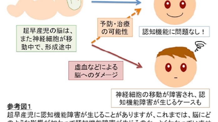 慶大とncnp 超早産児に生じる認知機能障害に脳の神経細胞の移動障害が関与することを発表 日本経済新聞