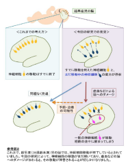 慶大とncnp 超早産児に生じる認知機能障害に脳の神経細胞の移動障害が関与することを発表 日本経済新聞