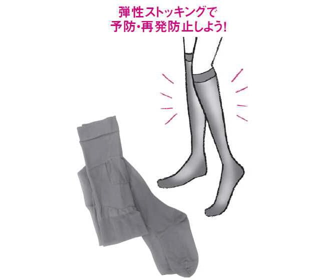 下肢静脈瘤の治療は日帰りで レーザーも保険が効く Nikkei Style