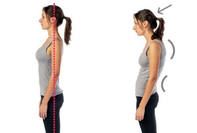 腰痛や肩こりと関係の深い2大生活習慣は「姿勢」と「ストレス」(c)undrey -123rf