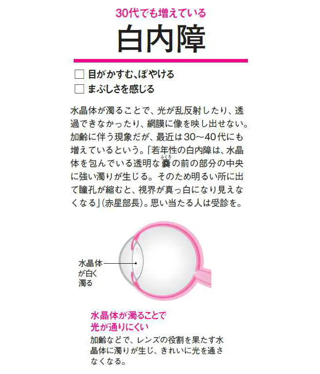 30代でも増える白内障 根治治療は手術 日帰り可能 Nikkei Style 30代でも増える白内障 根治治療は手術 日帰り可能 Nikkei Style