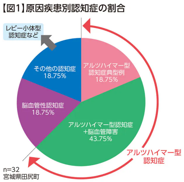 知れば慌てない 認知症の種類で異なる 食事の困難 Nikkei Style