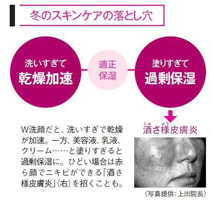 保湿しすぎのサインは?
