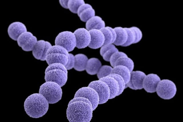 致死率30 人食いバクテリア の正体 対処法は Nikkei Style 致死率30 人食いバクテリア の正体 対処法は Nikkei Style