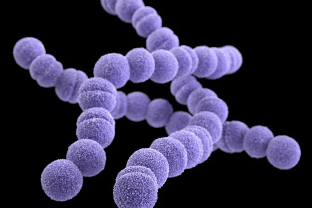 致死率30 人食いバクテリア の正体 対処法は Nikkei Style 致死率30 人食いバクテリア の正体 対処法は Nikkei Style