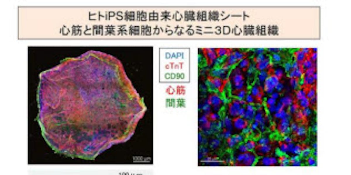 京大など ヒトips細胞から3次元的な心臓組織を作製し致死性不整脈の複雑な特徴を培養下に再現することに成功 日本経済新聞 京大など ヒトips細胞から3次元的な心臓組織を作製し致死性不整脈の複雑な特徴を培養下に再現することに成功 日本経済新聞