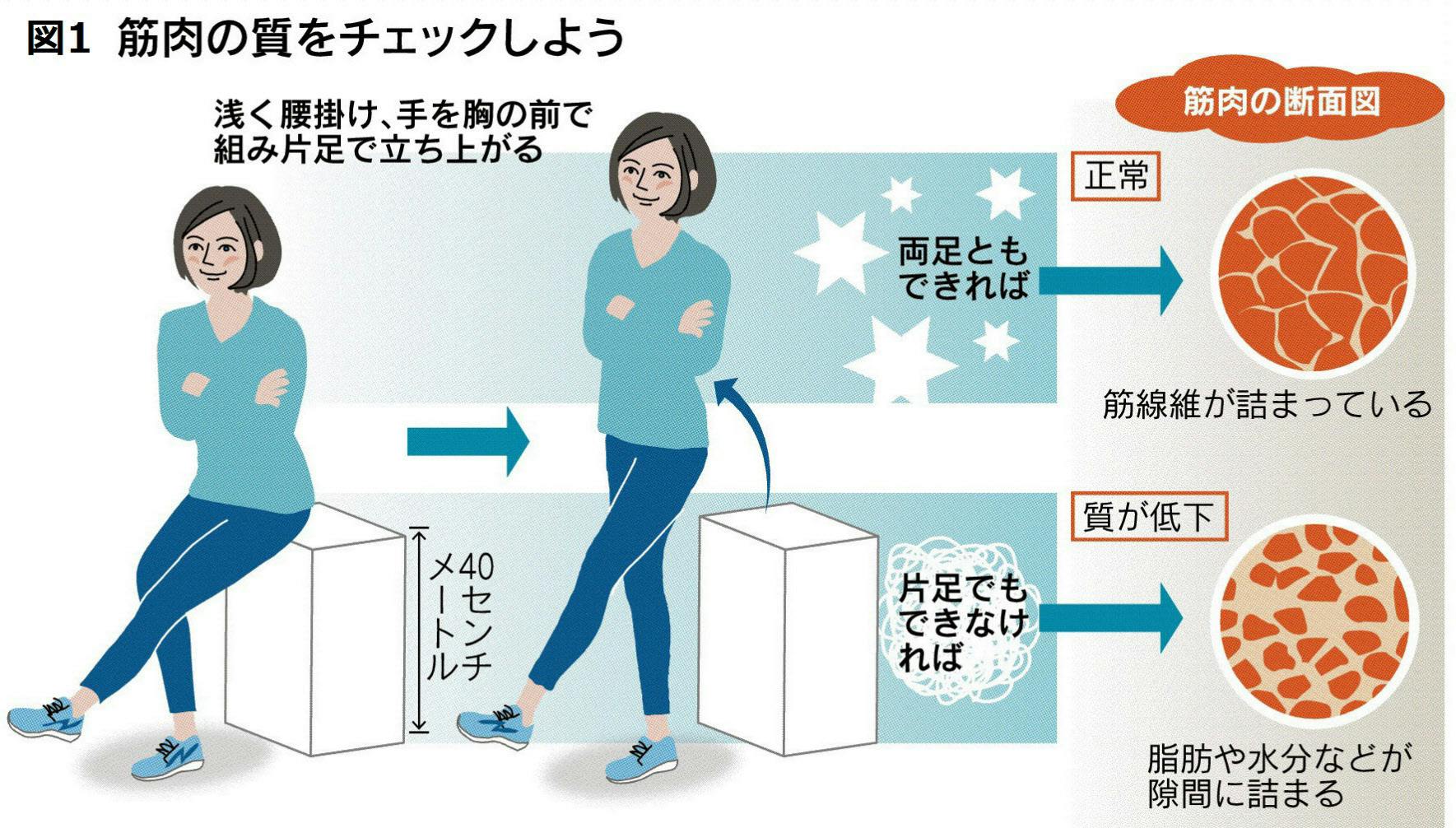 筋肉は 質の低下 に注意 同じ太さでも足腰に衰え Nikkei Style 筋肉は 質の低下 に注意 同じ太さでも足腰に衰え Nikkei Style