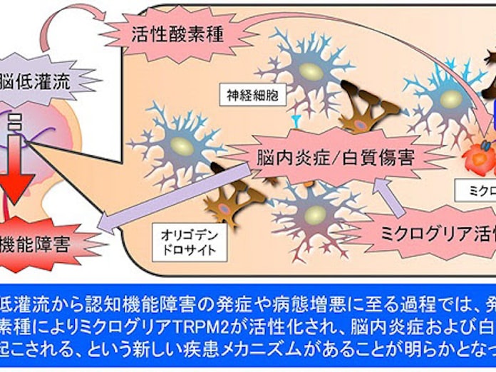 京大 脳の免疫細胞 ミクログリア と認知機能障害の因果関係を解明 日本経済新聞