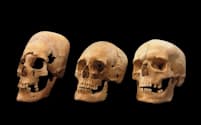 ドイツ南部にある1400年前の墓地で見つかった頭骨には、人為的に変形された跡があった。左側の頭骨は大きく変形され、中央はわずかに変形されたもの。専門家は、頭蓋変形がドイツよりも東方に住む民族の風習だったと考えている（PHOTOGRAPH BY STATE COLLECTION FOR ANTHROPOLOGY AND PALEOANATOMY MUNICH, GERMANY）