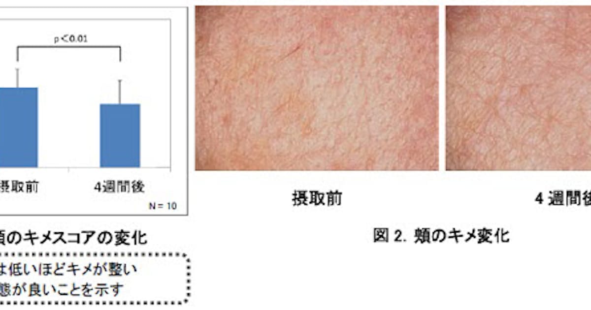 コーセー ハトムギ で透明感のある肌に経口摂取による肌への効果を検証し結果を発表 日本経済新聞 コーセー ハトムギ で透明感のある肌に経口摂取による肌への効果を検証し結果を発表 日本経済新聞
