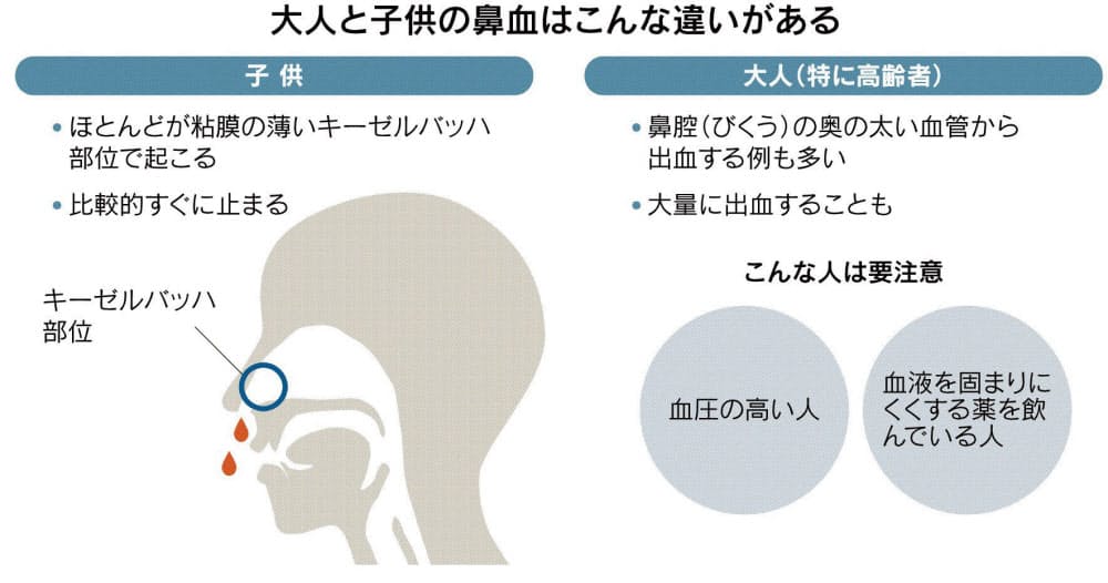 大人の鼻血に要注意 高血圧や飲んでいる薬の影響も Nikkei Style