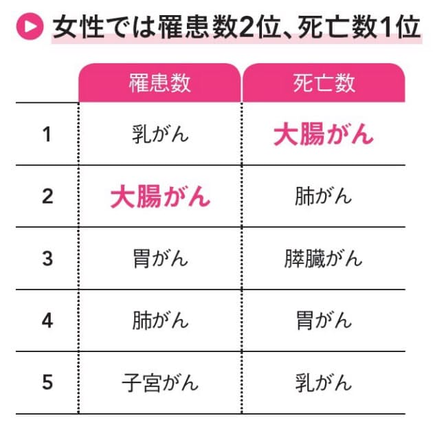女性のがん死1位 命を守る40代からの大腸がん対策 Nikkei Style