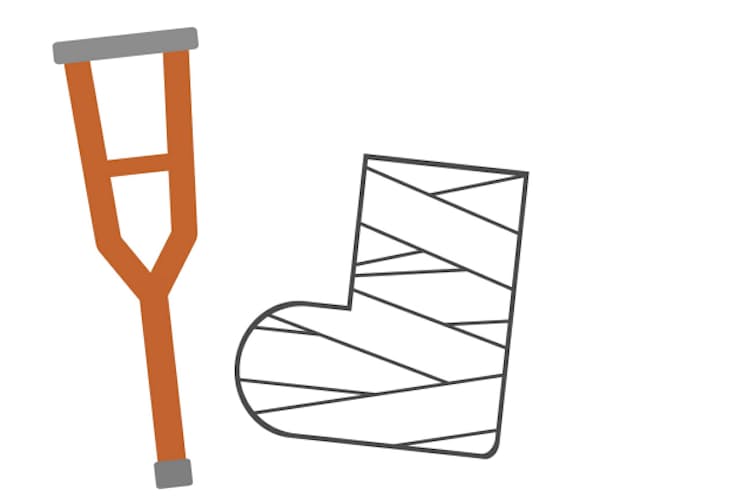 まさかの骨折 妄想に浸る余裕なくなる Nikkei Style まさかの骨折 妄想に浸る余裕なくなる Nikkei Style