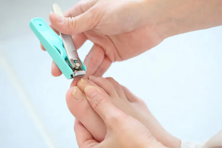 巻き爪 食い込んだ爪 カールしないよう爪を広げる Nikkei Style 巻き爪 食い込んだ爪 カールしないよう爪を広げる Nikkei Style
