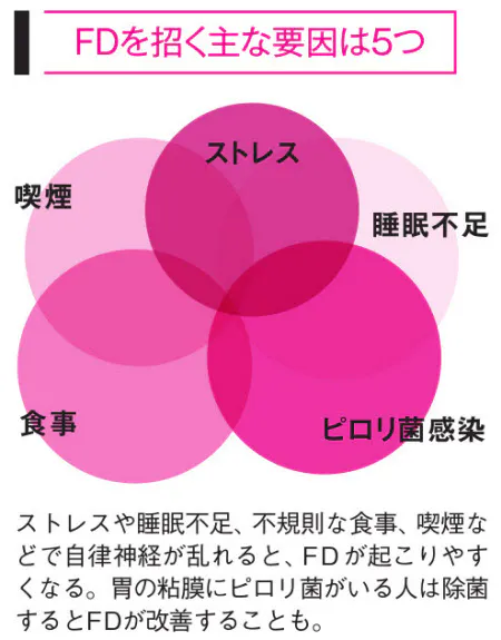 内視鏡で異常なし なぜか続く胃の不快感の原因は Nikkei Style